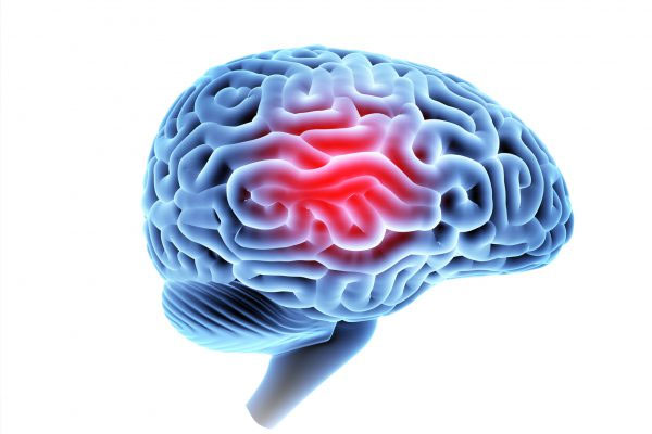 Brain-Injuries https://losangeles-personalinjuryattorney.com/wp-content/uploads/2023/06/Brain-Injuries.jpg